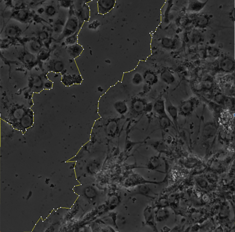 Wound healing analysis software picture